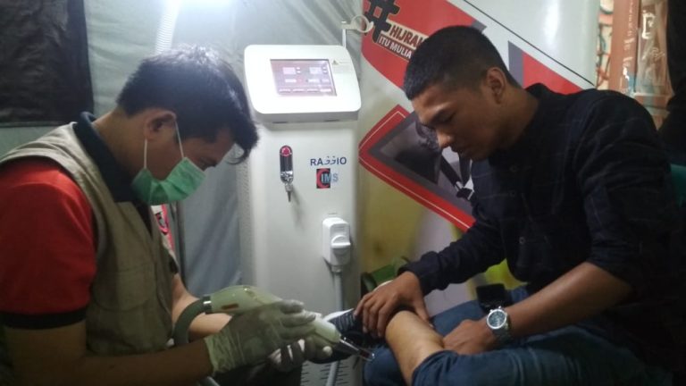 BMM dan IMS Gelar Baksos Hapus Tato di Yogyakarta