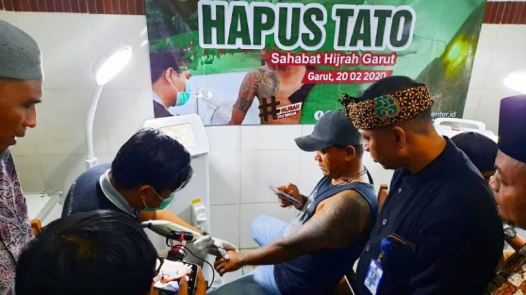 Hidayatullah Garut Kerjasama IMS dan Klinik 11 Duabelas Hapus Tato 54 Sahabat Hijrah
