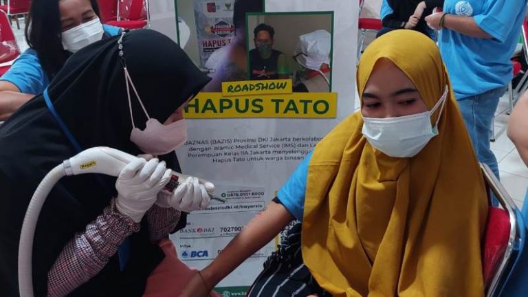IMS Beri Layanan Hapus Tato 34 Warga Binaan Lapas