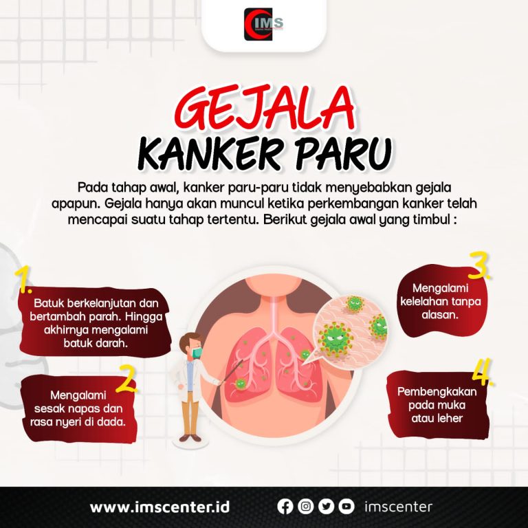 Lebih dari Sekedar Batuk, Begini Gejala Kanker Paru yang Perlu Diwaspadai